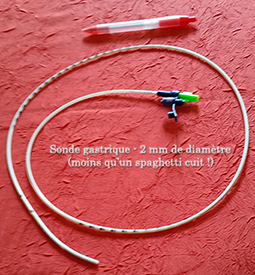 sonde_gastrique.png